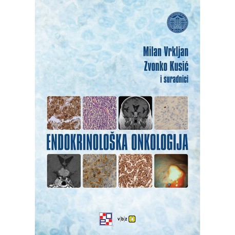 ENDOKRINOLOŠKA ONKOLOGIJA