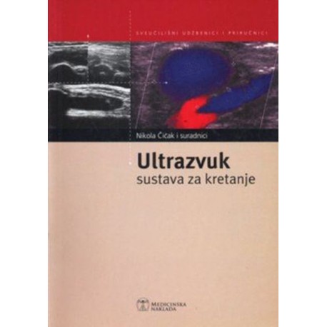 ULTRAZVUK SUSTAVA ZA KRETANJE