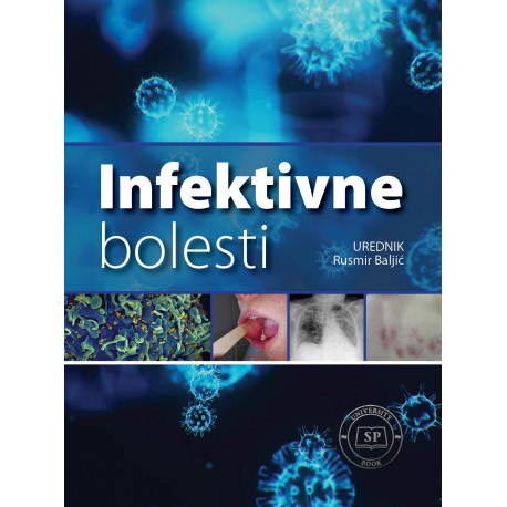 INFEKTIVNE BOLESTI