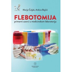 FLEBOTOMIJA