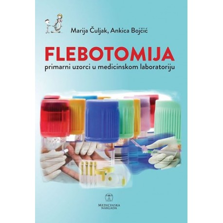 FLEBOTOMIJA