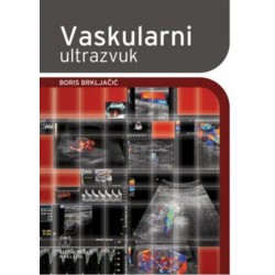 VASKULARNI ULTRAZVUK