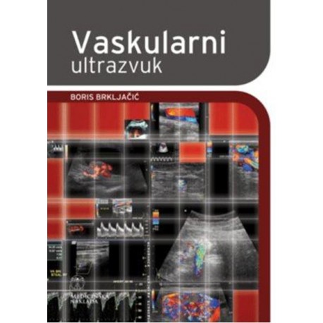 VASKULARNI ULTRAZVUK