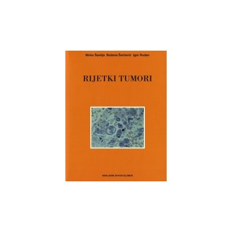 RIJETKI TUMORI