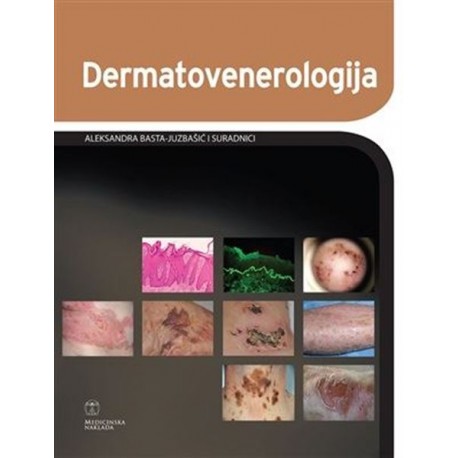 DERMATOVENEROLOGIJA