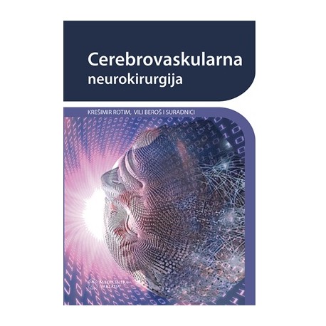 Cerebrovaskularna neurokirurgija