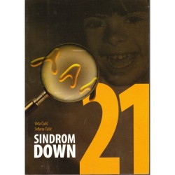 SINDROM DOWN
