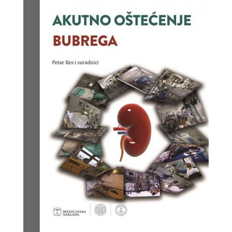 AKUTNO OŠTEĆENJE BUBREGA