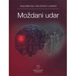 Moždani udar