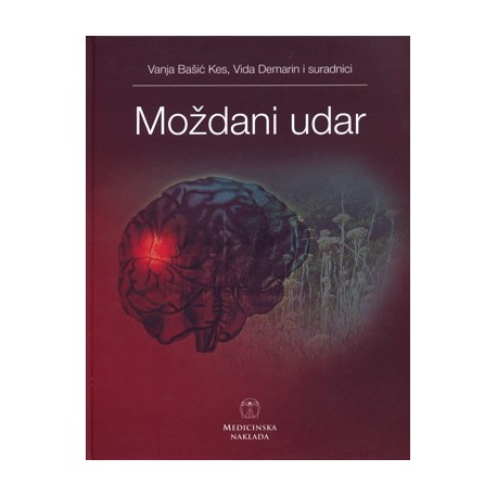 Moždani udar