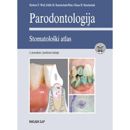 PARODONTOLOGIJA - STOMATOLOŠKI ATLAS