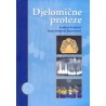 DJELOMIČNE PROTEZE