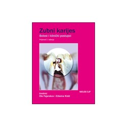 ZUBNI KARIJES