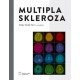 MULTIPLA SKLEROZA