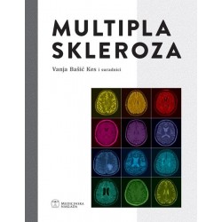 MULTIPLA SKLEROZA