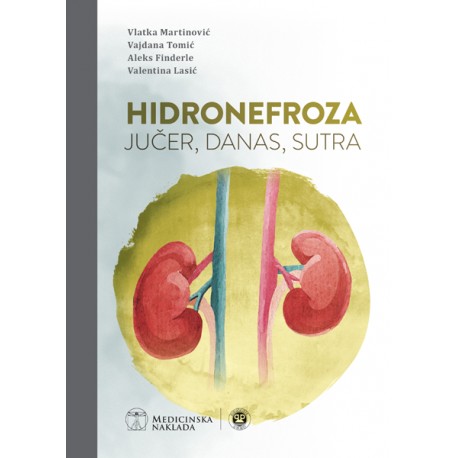 HIDRONEFROZA, JUČER, DANAS, SUTRA