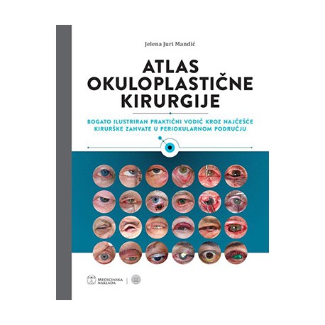 ATLAS OKULOPLASTIČNE KIRURGIJE