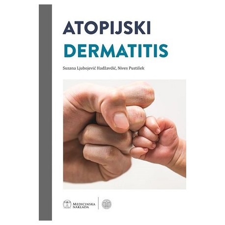 ATOPIJSKI DERMATITIS