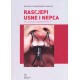 RASCJEPI USNE I NEPCA