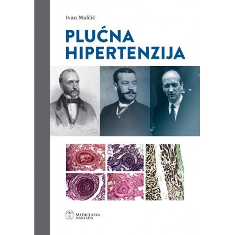 PLUĆNA HIPERTENZIJA